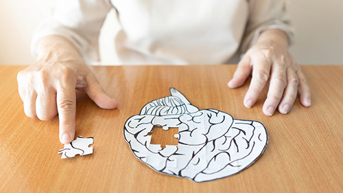 The Three Major Alzheimer’s Disease Stages with Brief Description - Villa Rica, GA